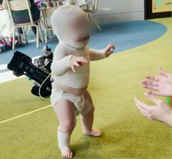 Батьки обгорілого малюка Луки порушують мовчання, дізнавшись, що підлий нападник на їхнього сина втік за кордон: «Розриває серце» 13858839 13990803 14353531