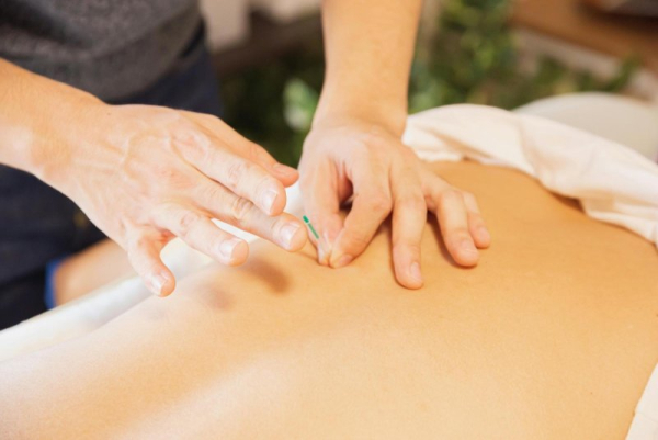 A study funded by the National Institutes of Health revealed acupuncture needling provided greater improvements in back pain–related disability at six months and 12 months compared with traditional medical care alone. Photo by Ryutaro Tsukata/Pexels