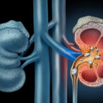 Робота в нічну зміну пов’язана з підвищеним ризиком…