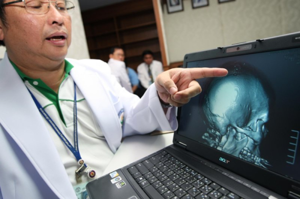 Seniors who suffered concussions were found to be more likely to develop dementia, requiring home care services or admission to a long-term care facility. File Photo by Narong Sangnak/EPA