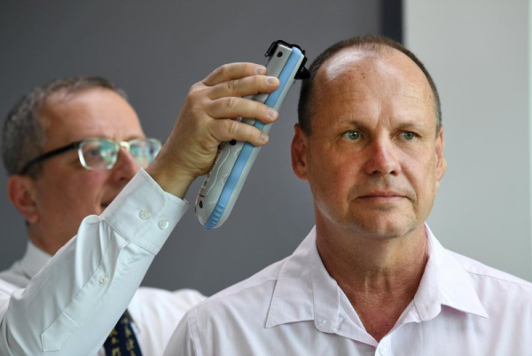 A new study by Queen Elizabeth University Hospital researchers suggests concussions and traumatic brain injuries could be early warning signs for ALS. File Photo by Dan Peled/EPA