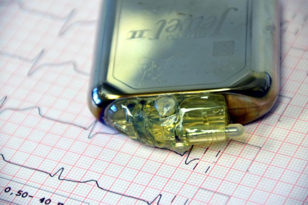 Chilean researchers having created a digital twin of the human heart can assist with pacemaker placement. Photo by ulleo/Pixabay