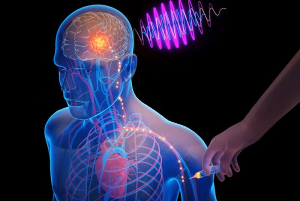 Дослідники MIT розробляють ін'єкційний чіп для лікування захворювань мозку