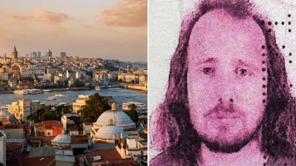 Перше фото 36-річного британця, який помер після перельоту до Туреччини для пересадки волосся