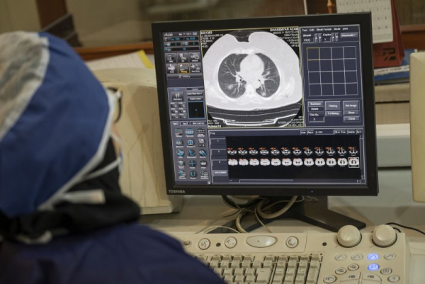 Nearly 16 million head CT scans were ordered by emergency rooms in 2022, up from under 8 million in 2007, researchers reported in a new study. File Photo by Morteza Nikoubazl/UPI