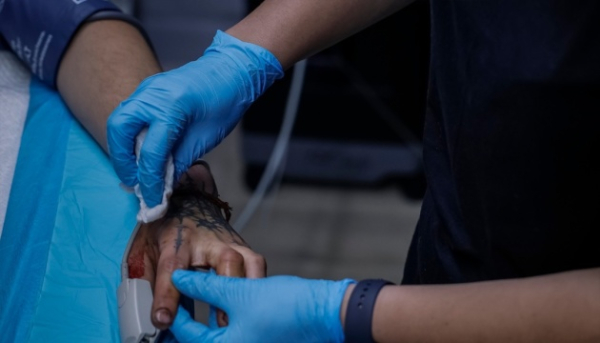 Інновації для військових медиків: Україна та НАТО розробили портативну штучну нирку й мікроінфузійну систему