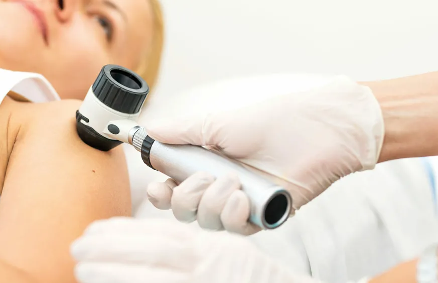 Консультація дерматолога: коли варто звернутися та чому не варто відкладати