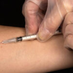 Відмова від проби Манту: з квітня Україна впроваджує оновлені способи&hellip;