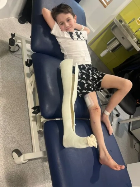 9-річний хлопчик став першим у Великій Британії, якому зробили новаторську операцію з подовження ніг 8