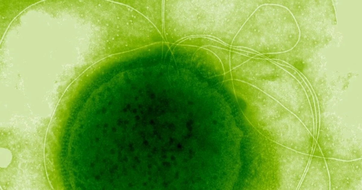 Thermococcus gammatolerans. Фото: Angels Tapias/CC BY 3.0 Thermococcus gammatolerans. Фото: Angels Tapias/CC BY 3.0